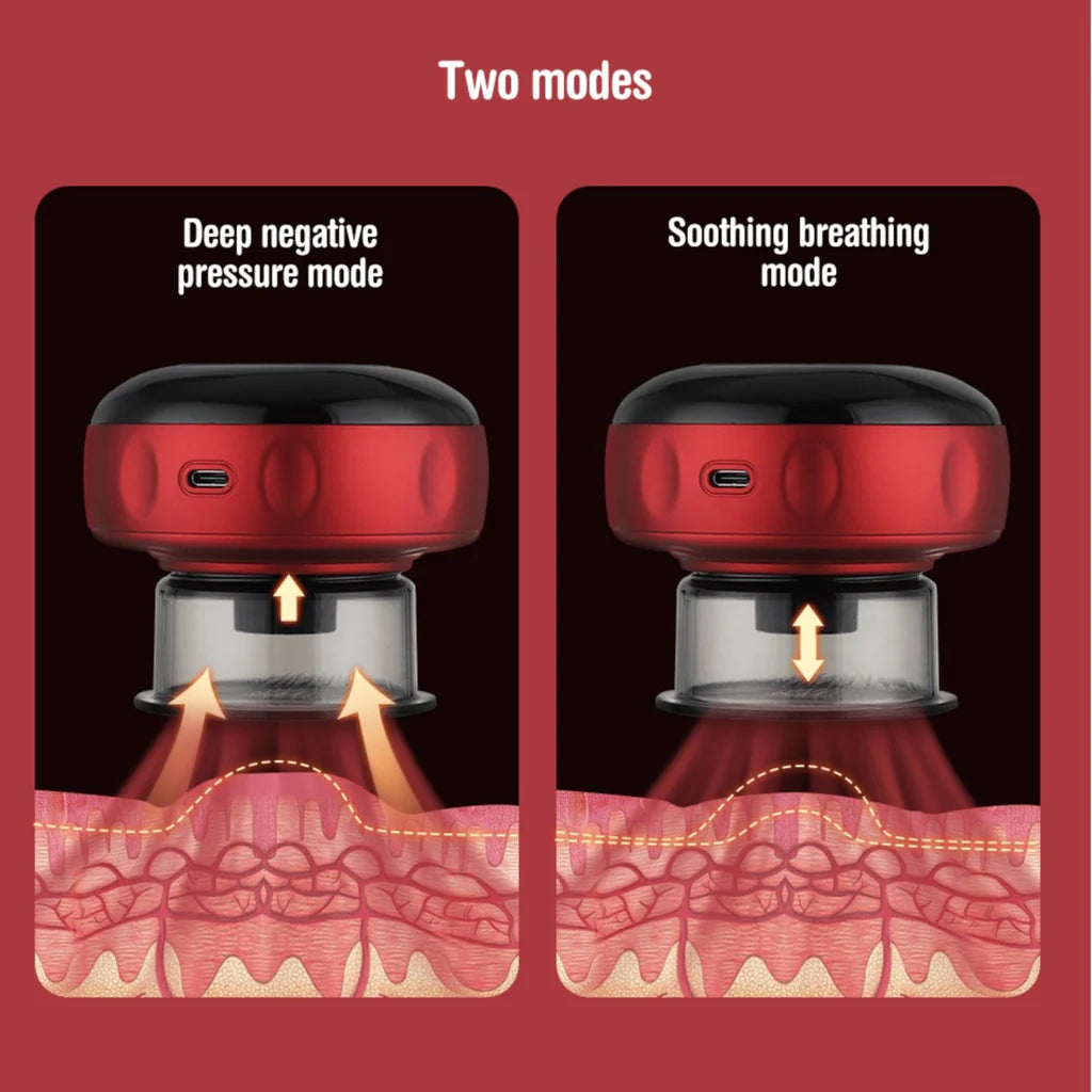 Smart Cupping Therapy Massager: Speed Up Your Recovery™