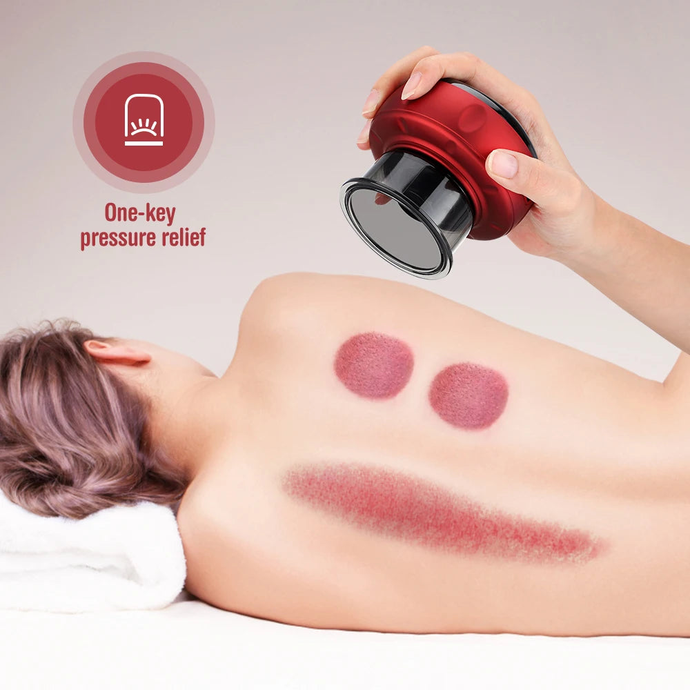 Smart Cupping Therapy Massager: Speed Up Your Recovery™