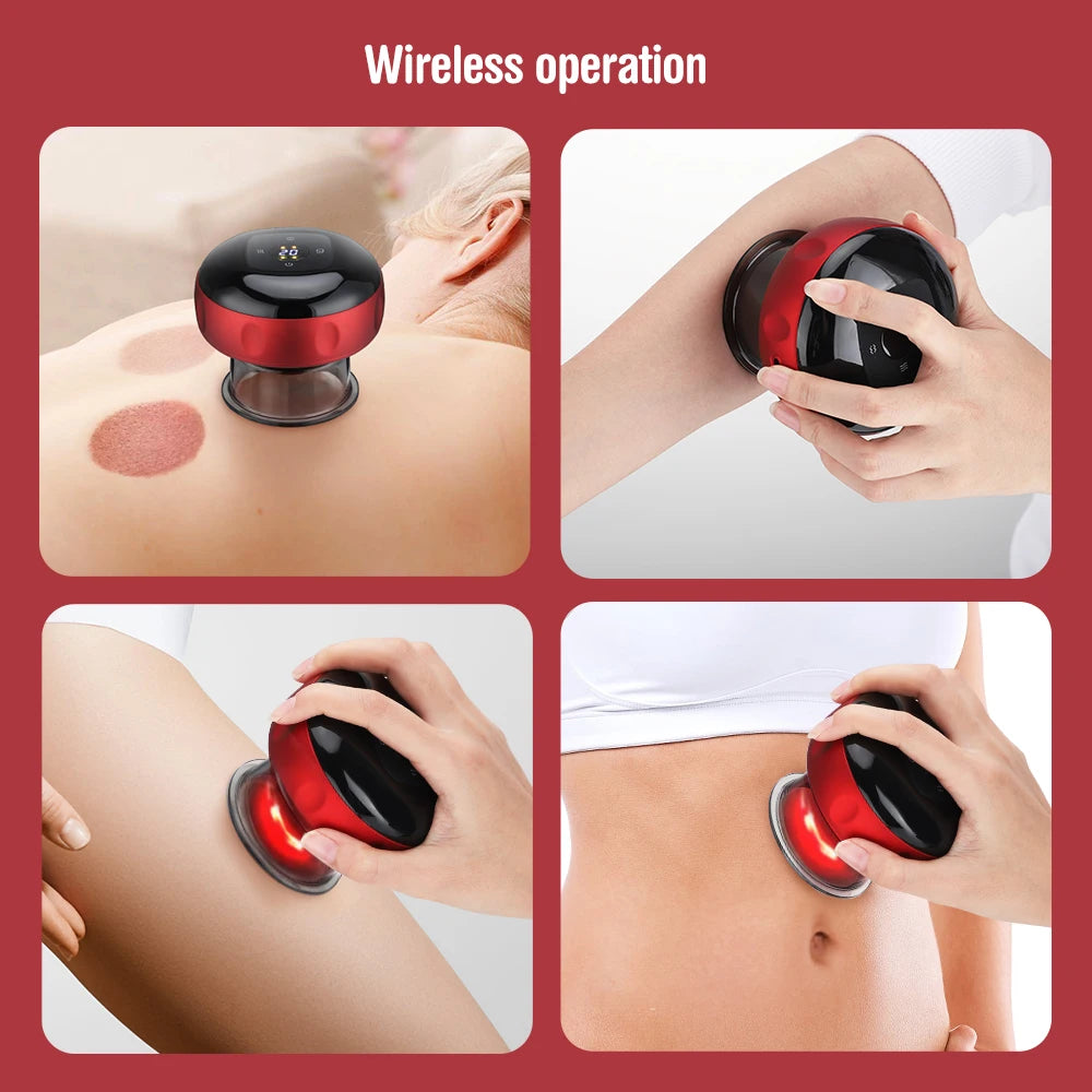 Smart Cupping Therapy Massager: Speed Up Your Recovery™