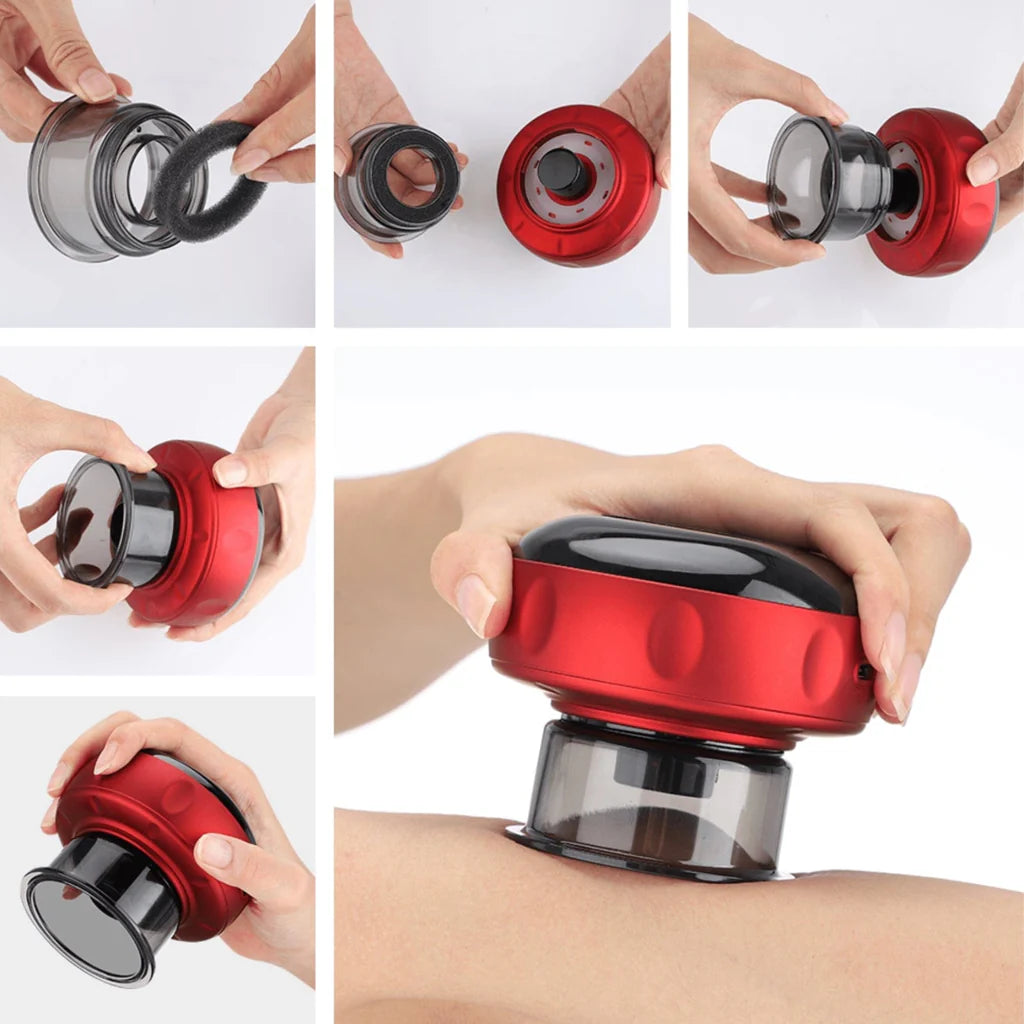 Smart Cupping Therapy Massager: Speed Up Your Recovery™