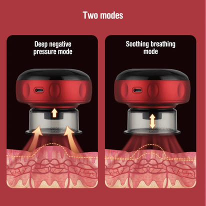 Smart Cupping Therapy Massager: Speed Up Your Recovery™